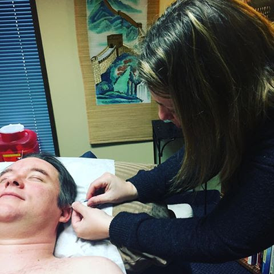Woman inserting an acupuncture needling into a man's earlobe as he lays on a table